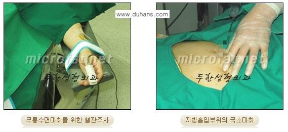 [두한성형외과 경쟁력 바디성형] - [아랫배, 윗배, 옆구리살, 허리살, 팔뚝살 지방흡입] 관련 이미지 2