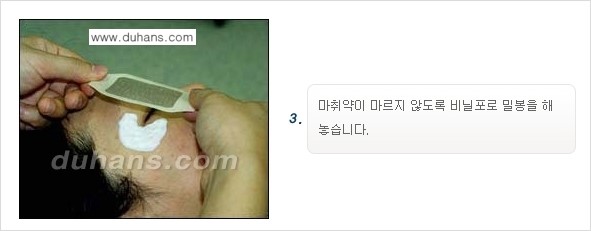 [두한성형외과 젊어지는 주름교정술] - [주름제거 시술방법 ④] 관련 이미지 6