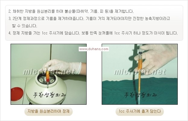 [두한성형외과 경쟁력 쌍꺼풀 재수술, 극한 눈재수술] - [삼중 쌍꺼풀 라인, 눈꺼풀이 함몰된 삼중 라인 교정 안내] 관련 이미지 15