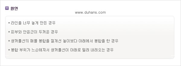 [두한성형외과 NO.1 "극한 눈 재수술"] - [절개선 아래가 두툼한 소세지 쌍꺼풀 교정] 관련 이미지 3