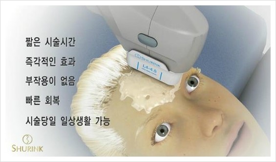 [두한성형외과 경쟁력 주름성형] - [주름제거를 위한 리프팅] 관련 이미지 33