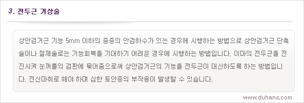 [두한성형외과 경쟁력 쌍꺼풀 재수술, 극한 눈재수술] - [안검하수 검사 및 수술방법 안내] 관련 이미지 8