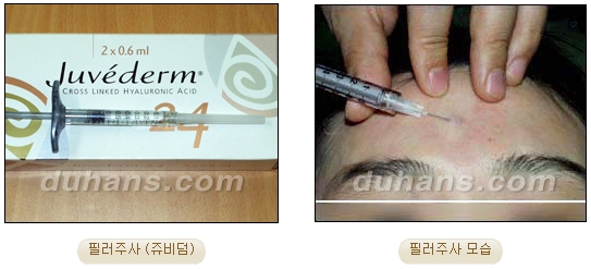 ​[두한성형외과 안티에이징] - [보톡스, 필러, 지방이식을 이용한 주름개선] 관련 이미지 9