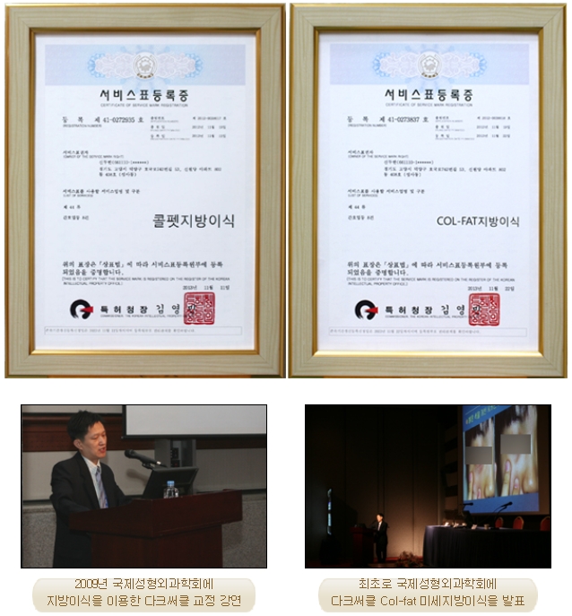 [두한성형외과 지방이식] - [다크써클, 눈​밑주름] 관련 이미지 1