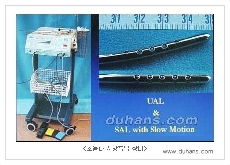 [두한성형외과 성형 FOCUS 지방흡입] - [액취증 - 다한증 초음파 컷터 지방흡입 ②] 관련 이미지 2