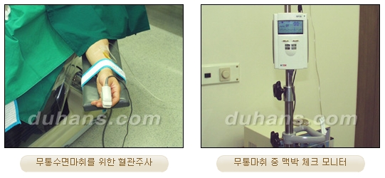 [Duhan Plastic Surgery Double Eyelid Surgery] - [Types of Double Eyelid Surgery] image 43
