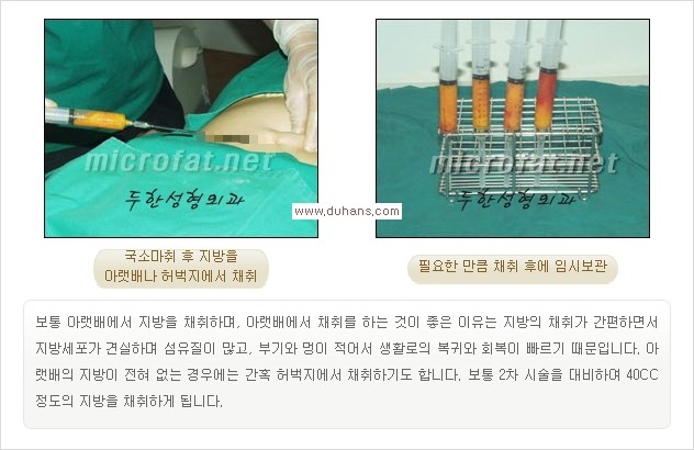 [두한성형외과 경쟁력 주름성형] - [필러주사(쥬비덤)에 대한 올바른 정보 안내] 관련 이미지 4