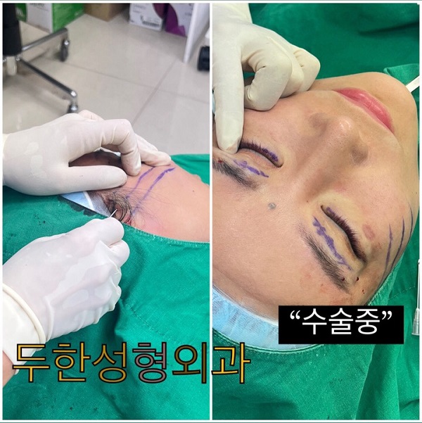 Recommended Duhan Plastic Surgery!! image 2