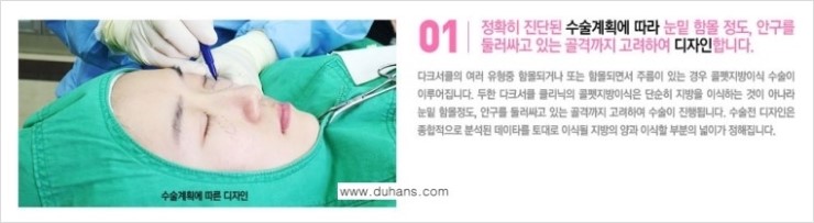 [두한성형외과 FOCUS 눈밑성형] - [다크써클의 치료방법 -  콜펫(Col-fat) 눈밑 미세지방이식 ③] 관련 이미지 6