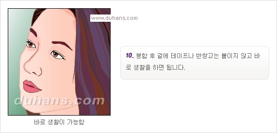 [두한성형외과 경쟁력 코성형] - [코성형을 위한 알로덤(슈어덤) 수술, 실리콘 수술 안내] 관련 이미지 13