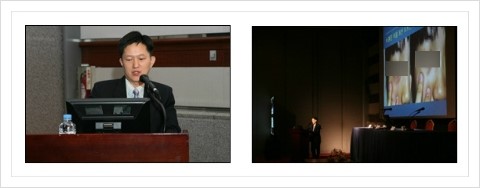 [두한성형외과 경쟁력 다크써클 치료] - [다크써클 + 눈위 지방이식 콤비 프로그램] 관련 이미지 11