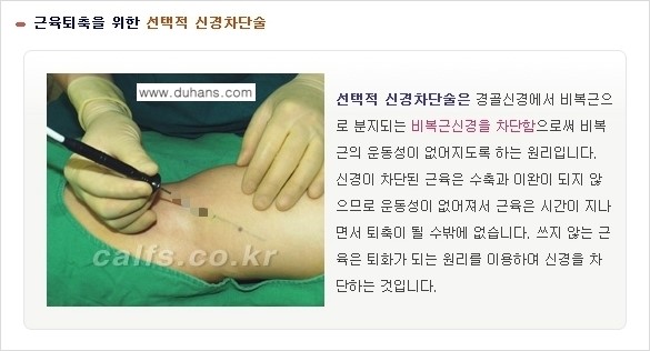 [두한성형외과 날씬한 종아리 만들기!] - [종아리 성형 안내 1.] 관련 이미지 5