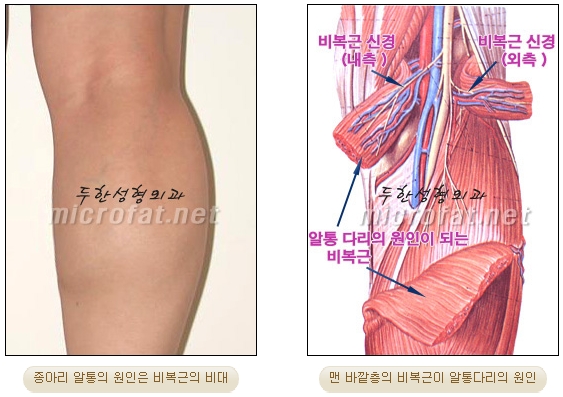 [Duhan Plastic Surgery Clinic Calf Contouring] - [Calf Reduction] image 5