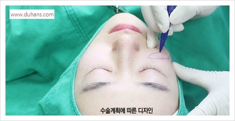 [두한성형외과 경쟁력 멀티성형] - [다크써클 + 인디언밴드 콤비 프로그램 안내] 관련 이미지 2