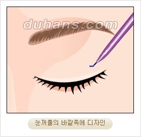 ⁠⁠[두한성형외과 경쟁력 안검성형] - [젊은 눈매를 위한 윗눈꺼풀 지방제거, 눈밑 지방제거] 관련 이미지 3