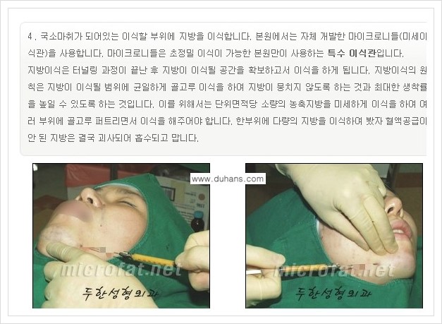 [두한성형외과의 경쟁력 미세지방이식] - [무턱교정, 턱 미세지방이식 안내 1.] 관련 이미지 11