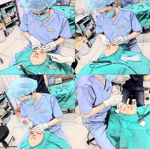 [두한성형외과 쌍꺼풀재수술] - [쌍꺼풀재수술성공요건, 쌍꺼풀재수술과정] 관련 이미지 16