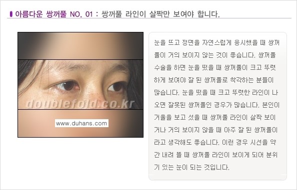 [두한성형외과 NO.1 눈성형] - [일반적인 기준의 아름다운 쌍꺼풀 모음] 관련 이미지 1