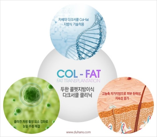 ​[두한성형외과 경쟁력 눈밑성형 리더] - [눈밑 다크써클의 증상, 원인, 종류, 치료방법 안내] 관련 이미지 3