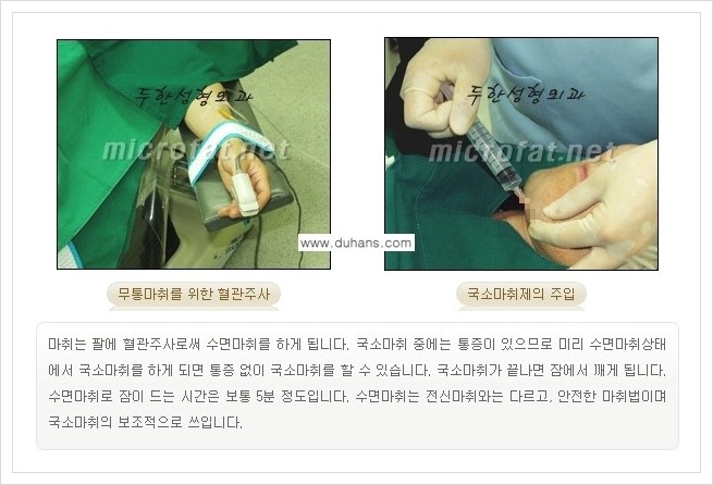 [두한성형외과 경쟁력 미세지방이식] - [타병원에서의 미세지방이식 부작용 교정 방법 안내] 관련 이미지 2