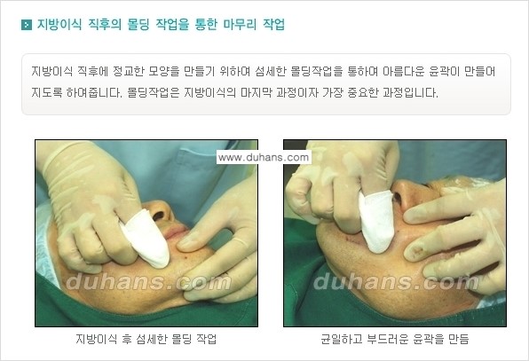[두한성형외과 NO.1 지방이식]-[두한 지방이식 클리닉의 특징] 관련 이미지 14