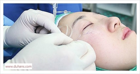 [두한성형외과 경쟁력 눈밑성형] - [푸른 다크써클 "눈밑푸른혈관" 치료] 관련 이미지 4