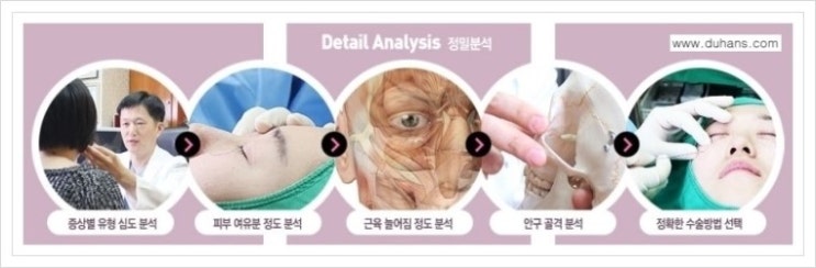 [두한성형외과 경쟁력 다크써클 교정] - [다크써클 5단계로 이뤄지는 핵심 5 STEP SOLUTION 안내 1.] 관련 이미지 8