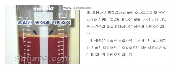 [두한성형외과 성형 FOCUS 지방흡입] - [액취증 - 다한증 초음파 컷터 지방흡입 ④] 관련 이미지 11