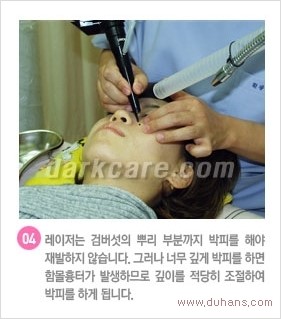 [두한성형외과 경쟁력 눈밑성형] - [다크써클 + 검버섯 레이저 콤비 프로그램 안내] 관련 이미지 8
