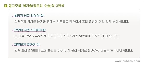 [두한성형외과 경쟁력 눈성형] - [앞트임(몽고주름 제거) 수술 안내 ①] 관련 이미지 5