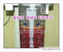 [두한성형외과 경쟁력 액취증 치료] - [참기 힘든 겨드랑이 냄새 액취증, 암내 치료] 관련 이미지 10