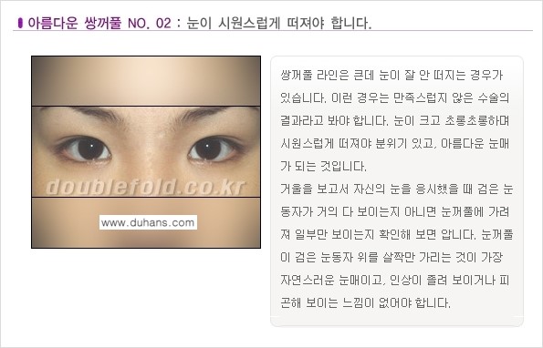 [두한성형외과 NO.1 눈성형] - [일반적인 기준의 아름다운 쌍꺼풀 모음] 관련 이미지 2