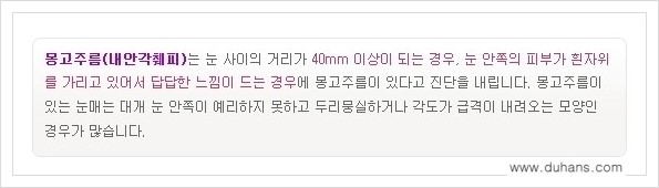 [두한성형외과 경쟁력 눈성형] - [앞트임 수술(몽고주름 제거) 안내 ①] 관련 이미지 3