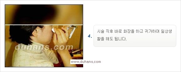 [두한성형외과 경쟁력 Quick 주름성형] - [주름교정을 위한 간편한 보톡스(보툴리눔톡신)] 관련 이미지 5