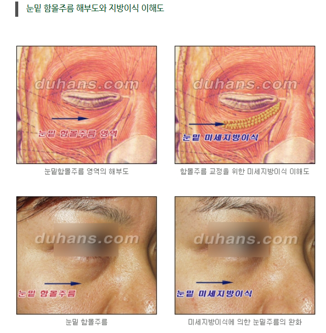 눈밑 다크써클 개선 원리 관련 이미지 10