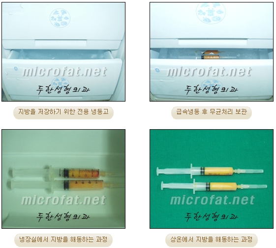 Fat Grafting Leader Duhan Plastic Surgery - Everything About Fat Grafting image 64