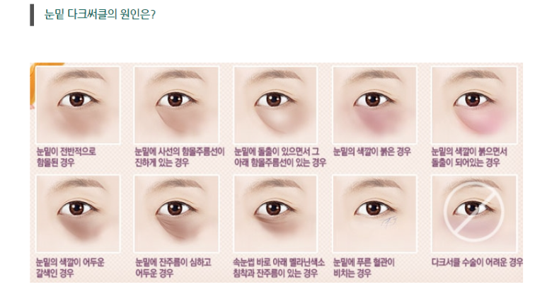 눈밑 다크써클 개선 원리 관련 이미지 3