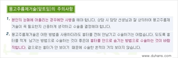 [두한성형외과 경쟁력 눈성형] - [몽고주름 제거수술, 앞트임 수술 안내] 관련 이미지 17