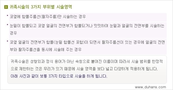 ⁠[두한성형외과 경쟁력 미세지방이식] - [귀족수술 - 입체미세지방이식 ①] 관련 이미지 4