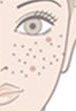 Duhan Plastic Surgery Laser Treatment - Mole Removal, Spot Removal, Melasma, Blemishes, Hyperpigmentation, Skin Tone Improvement, Elasticity Improvement, Skin Texture Improvement image 7