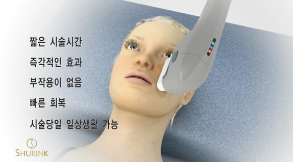 [Duhan Plastic Surgery Wrinkle Improvement] - [Wrinkle Lifting] image 38