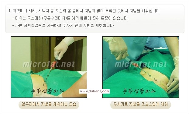 [두한성형외과 경쟁력 미세지방이식] - [부드럽고 아름다운 얼굴윤곽선 턱(하악부) 미세지방이식 안내] 관련 이미지 8