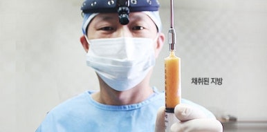 [두한성형외과 다크서클] - [다크서클 콜펫지방이식] 관련 이미지 8