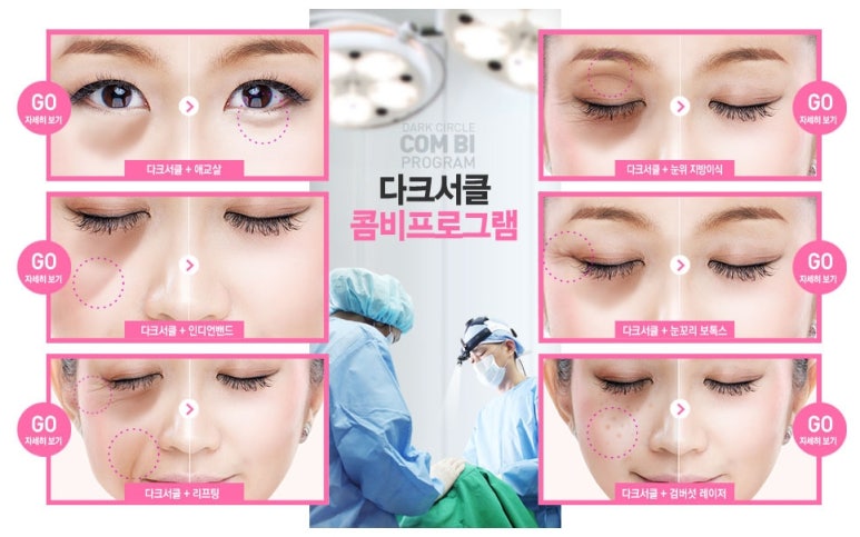 두한성형외과 눈밑수술 - 다크서클 수술 전후 관리 안내 관련 이미지 115