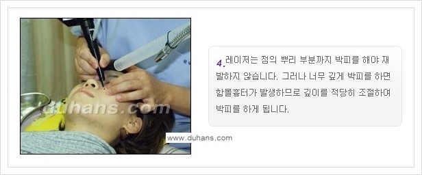 [두한성형외과 경쟁력 레이저시술] - [이산화탄소 점제거 안내] 관련 이미지 6