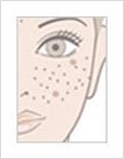 [두한성형외과 경쟁력 안전성형] - [최첨단 장비를 이용한 흉터, 점, 주근깨, 잡티, 문신제거 레이저 시술] 관련 이미지 8