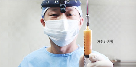 [눈밑수술 두한성형외과] - [다크서클 콤비프로그램] 관련 이미지 98