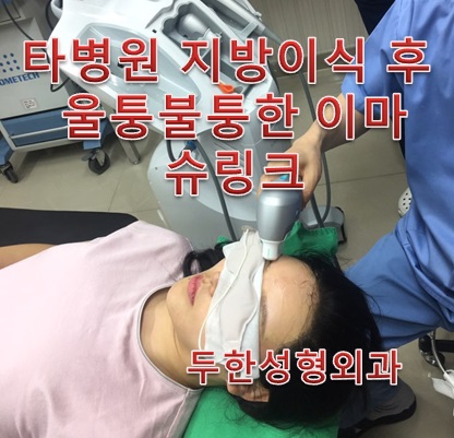 [두한성형외과 쌍꺼풀재수술, 이마슈링크]-[#라인낮추기 #소세지개선 #이마슈링크 #울퉁불퉁한이마개선] 관련 이미지 3