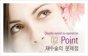 [두한성형외과 경쟁력 쌍꺼풀 재수술] - [쌍꺼풀 재수술 대상자의 이상적인 재수술] 관련 이미지 15