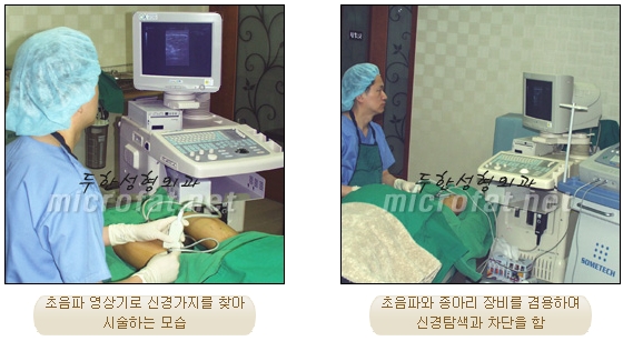 [Duhan Plastic Surgery Clinic Calf Contouring] - [Calf Reduction] image 11